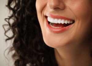 Minimally Invasive Smile Makeover | Ivoire Natural Smile | Paris 17