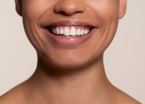 Sourire naturel et élégant | Ivoire Natural Smile | Paris 17