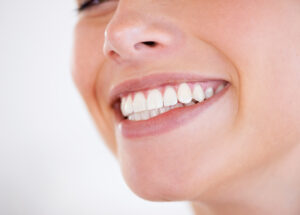 Facettes dentaires| Ivoire Natural Smile | Paris 17