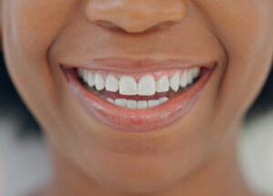 Soins de gencives esthétiques | Ivoire Natural Smile | Paris 17